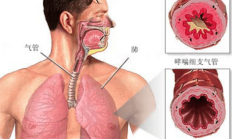 “一呼一吸”总关情 | 提示您：冬季谨防三大慢性气道疾病